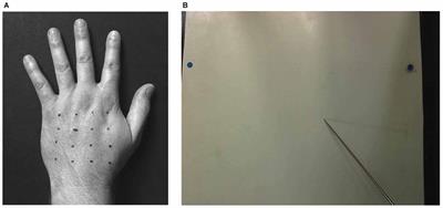 No Correlation between Distorted Body Representations Underlying Tactile Distance Perception and Position Sense